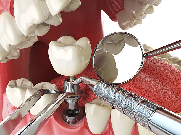Best Walk-In Emergency Dentist in Piney Mountain, VA
