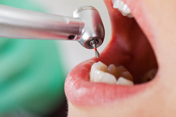 Best Same-Day Emergency Dentist in Piney Mountain, VA